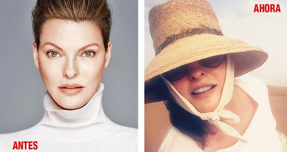  Evangelista en sus años mozos y hoy, a los 56 años, cuando usa todo tipo de atuendos para ocultar su cara, que quedó hinchada como consecuencia del tratamiento.