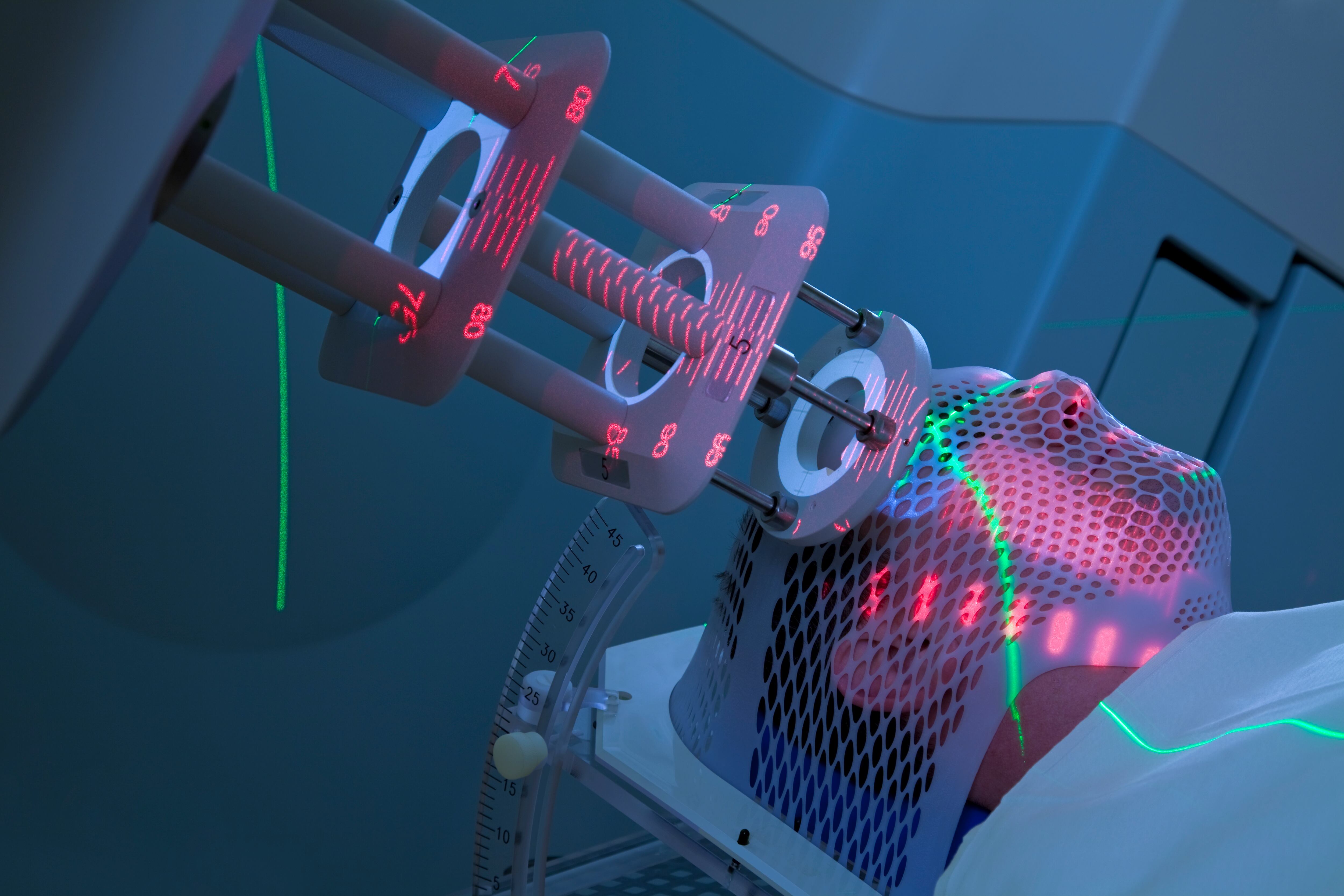 Hombre que recibe radioterapia (radioterapia) para el tratamiento del cáncer
[url = http: //www.istockphoto.com/file_search.php? action = file & lightboxID = 6833324] [img] http://www.kostich.com/cancer.jpg [/ img] [/ url]