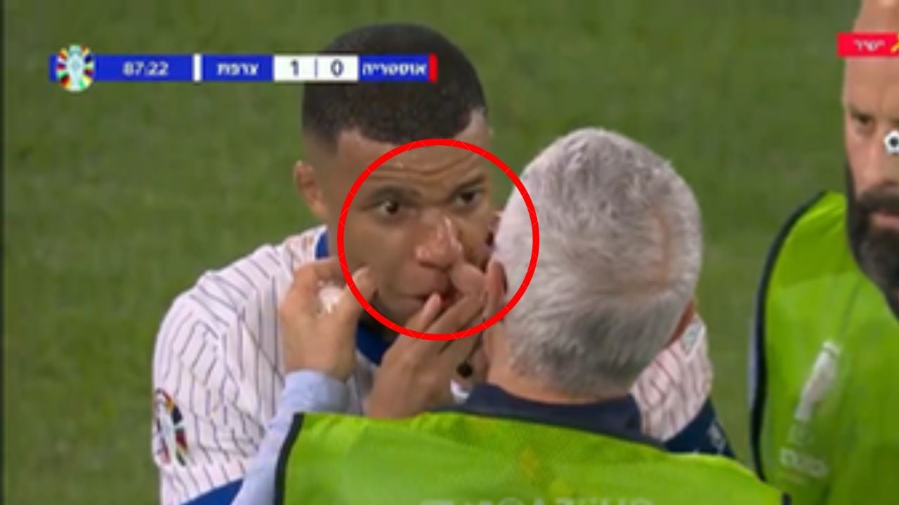 Mbappé sufre duro golpe.