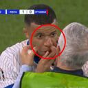 Mbappé sufre duro golpe.