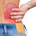 Los cálculos en los riñones pueden generar dolor y obstrucción para orinar.