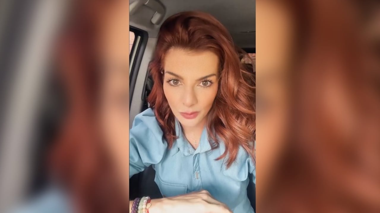 La presentadora Carolina Cruz habló de un problema en la piel que la acompleja.