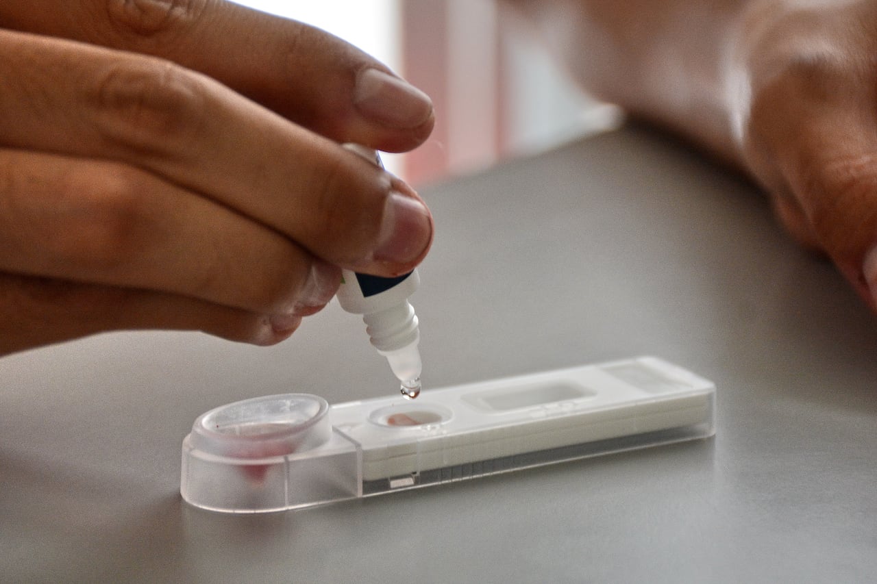 En el Hospital de Siloé, se puede acceder a pruebas gratuitas de VIH. La Secretaría de Salud de Cali ha instalado una máquina dispensadora de autotest de VIH en este centro de salud, la cual permite realizar pruebas rápidas, privadas y en solo 15 minutos. Foto Jorge Orozco /El País