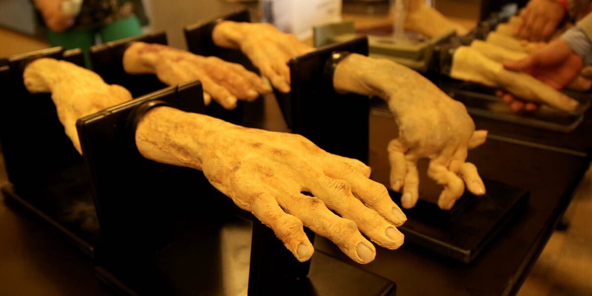 Dos reumatólogos y un médico general crearon modelos a escala del cuerpo humano para hablarle a toda clase de públicos sobre el diagnóstico temprano de enfermedades como la psoriasis o la artritis.