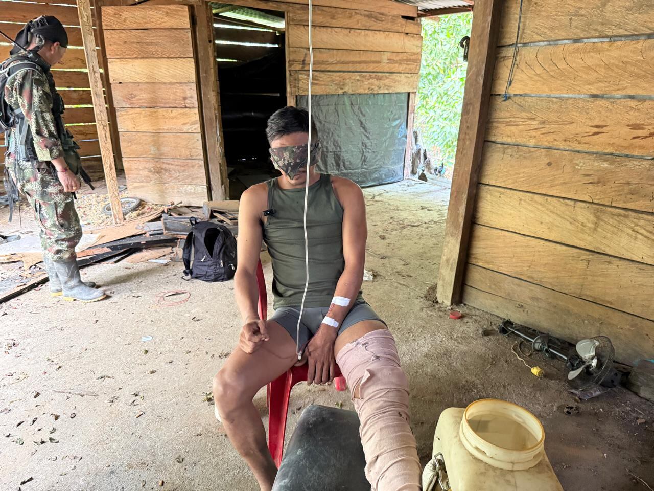 Uno de los guerrilleros del ELN heridos en el Catatumbo.