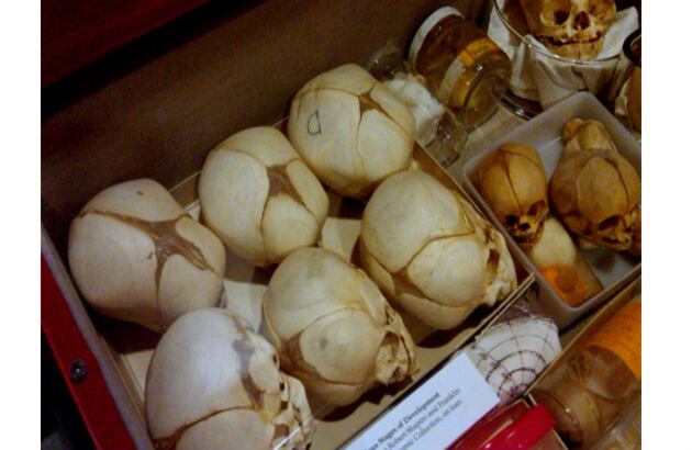 El doctor Harvey Cushing, conocido como el padre de la neurocirugía moderna y el fundador de esta colección, recolectaba los cráneos de sus pacientes que habían muerto durante la cirugía o posteriormente, para seguir avanzando en su técnica quirúrgica.  