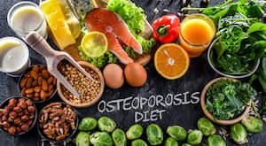 La osteoporosis es una enfermedad que afecta los hesos.