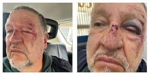 El adulto mayor que fue brutalmente golpeado luego de que tras tropezar intentó cogerse de otra persona para no caer al piso, no tiene comprometido ningún órgano vital, tiene hematomas y está en recuperación, informó su hija, Paula Guisado.