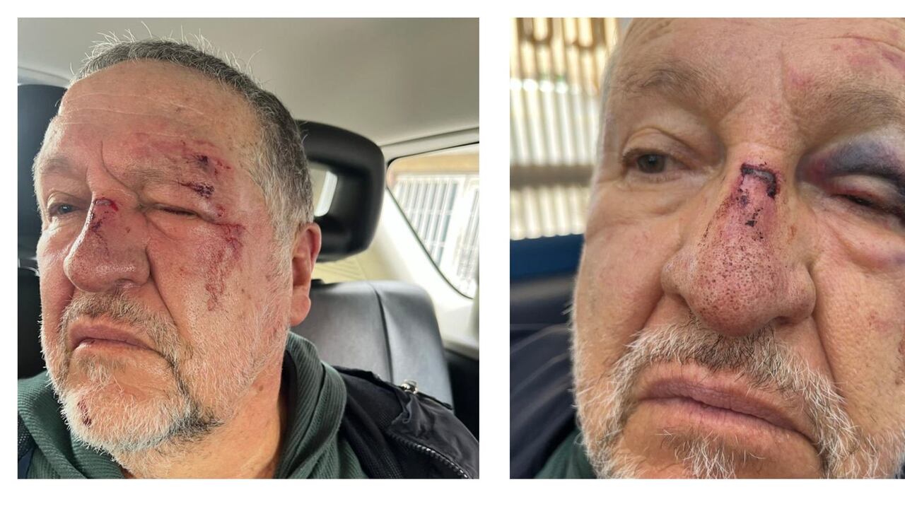 El adulto mayor que fue brutalmente golpeado luego de que tras tropezar intentó cogerse de otra persona para no caer al piso, no tiene comprometido ningún órgano vital, tiene hematomas y está en recuperación, informó su hija, Paula Guisado.