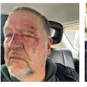 El adulto mayor que fue brutalmente golpeado luego de que tras tropezar intentó cogerse de otra persona para no caer al piso, no tiene comprometido ningún órgano vital, tiene hematomas y está en recuperación, informó su hija, Paula Guisado.