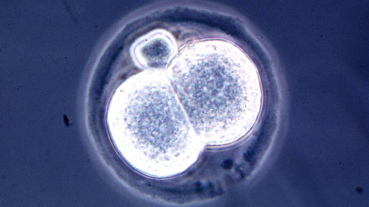 Imagen de referencia, no corresponde al caso en mención.