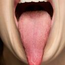 ¿Qué revela la lengua sobre la salud?