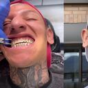 El influencer no estaba seguro de quitarse sus brackets. Fotos: Instagram @la_liendraa.