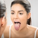 Esta condición puede propiciar el mal aliento.