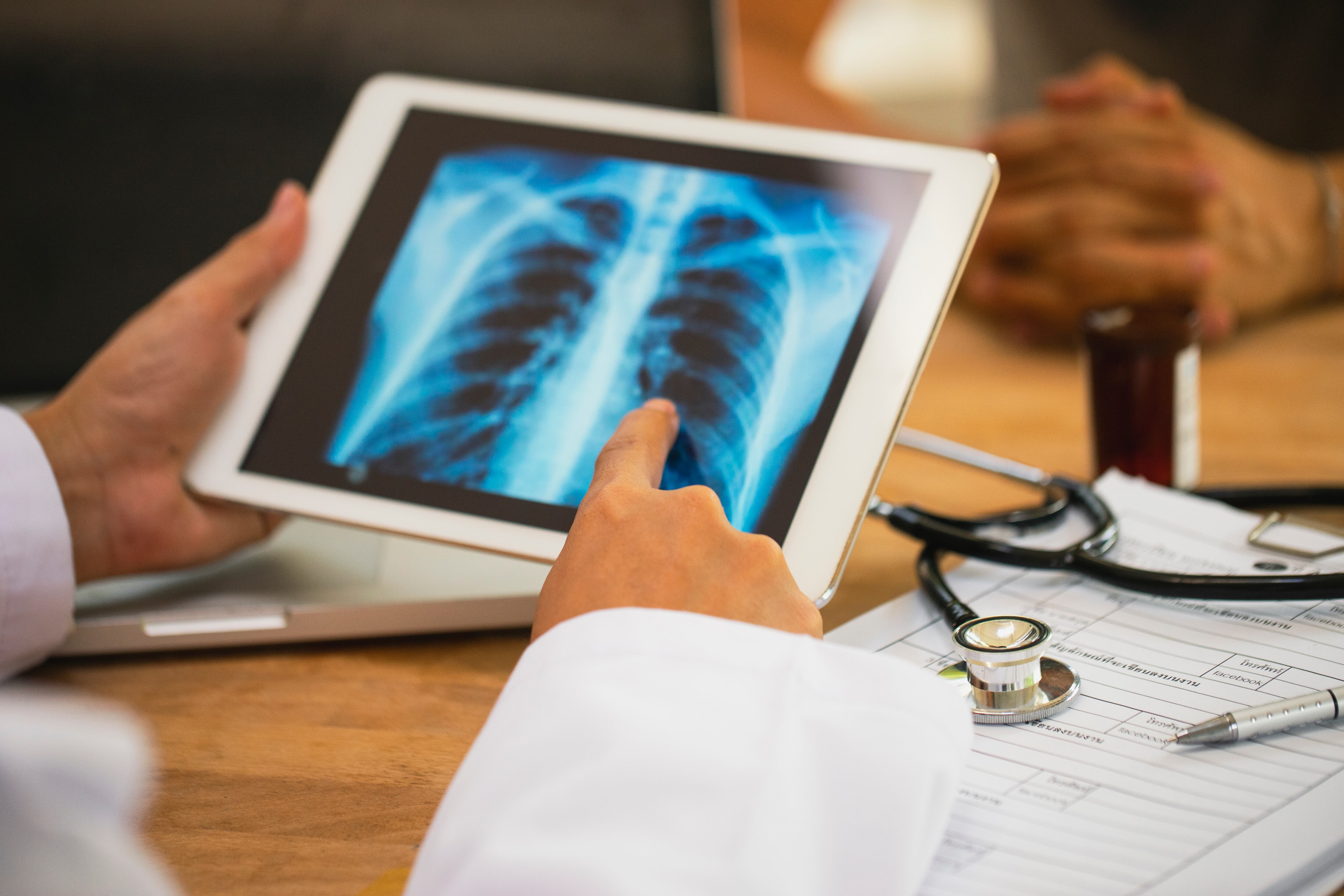 Ciertas de las enfermedades huérfanas afectan el sistema pulmonar. Algunas son productos de trastornos genéticos