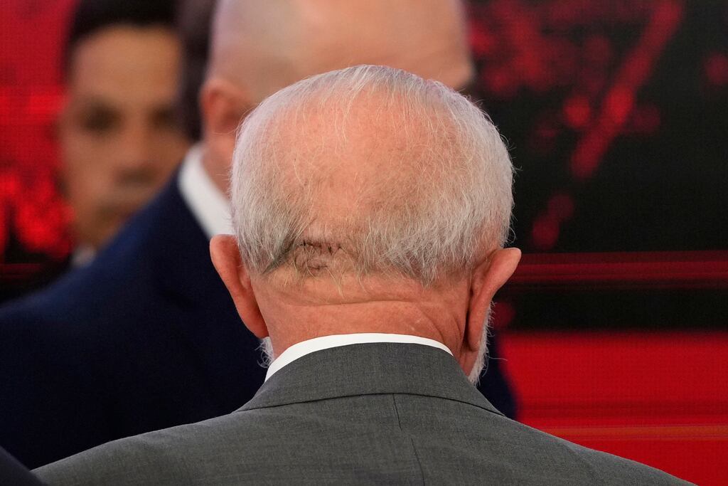 La parte posterior de la cabeza del presidente brasileño Luiz Inácio Lula da Silva muestra puntos resultantes de una caída, durante un evento en el Palacio Presidencial de Planalto en Brasilia, Brasil, el viernes 25 de octubre de 2024. (Foto AP/Eraldo Peres)