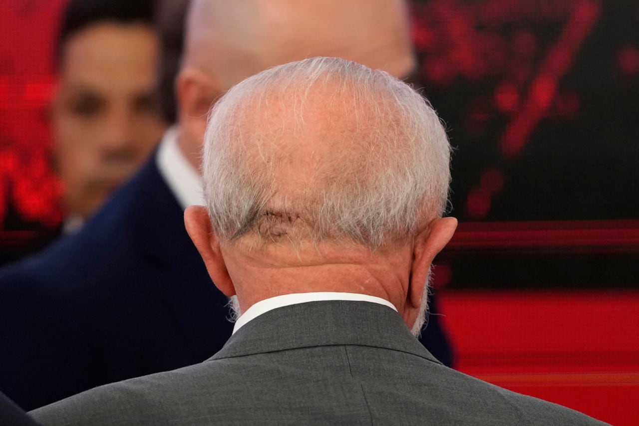La parte posterior de la cabeza del presidente brasileño Luiz Inácio Lula da Silva muestra puntos resultantes de una caída, durante un evento en el Palacio Presidencial de Planalto en Brasilia, Brasil, el viernes 25 de octubre de 2024. (Foto AP/Eraldo Peres)