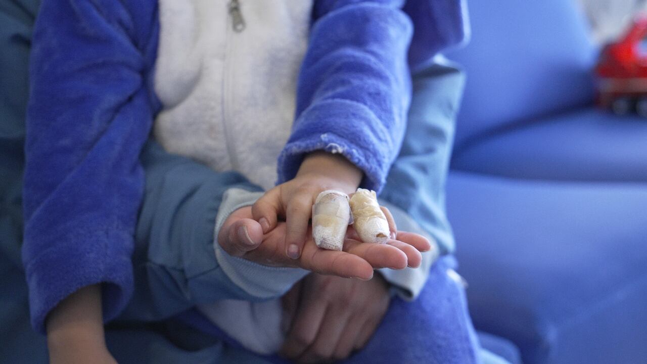 Entre los principales afectados por el uso ilegal de pólvora están los menores de edad, especialmente niños y niñas de primera infancia.