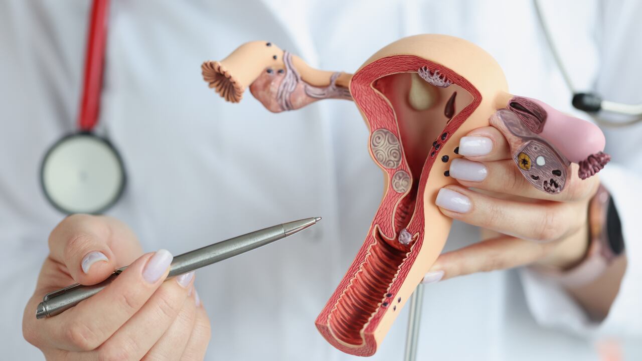 Cáncer de cuello uterino