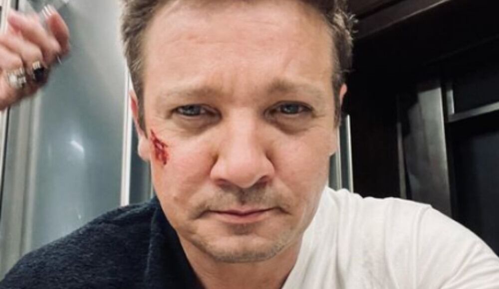 El actor sufrió un fuerte accidente y se encuentra recuperándose en casa.