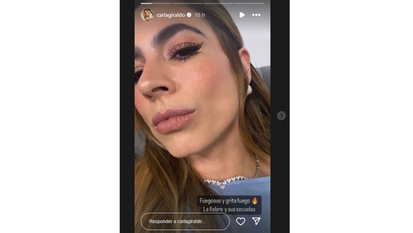 Carla Giraldo mostró las secuelas que sufre tras una afectación de salud que tuvo en medio de su labor en 'La casa de los famosos'