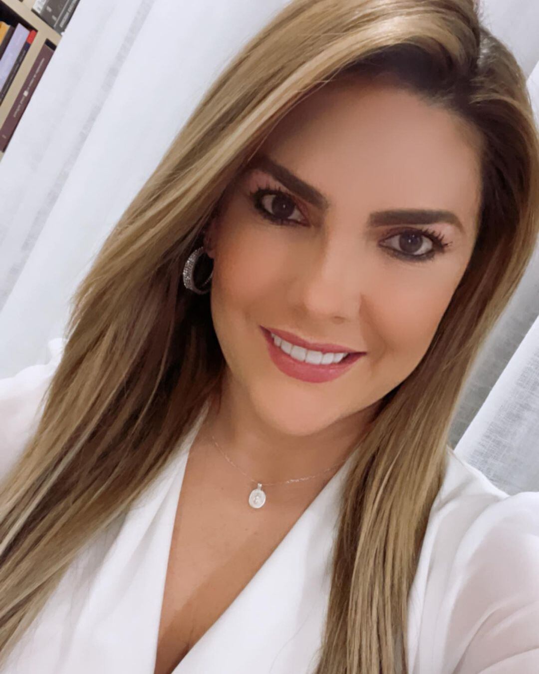 La cucuteña se ha hecho retoques estéticos