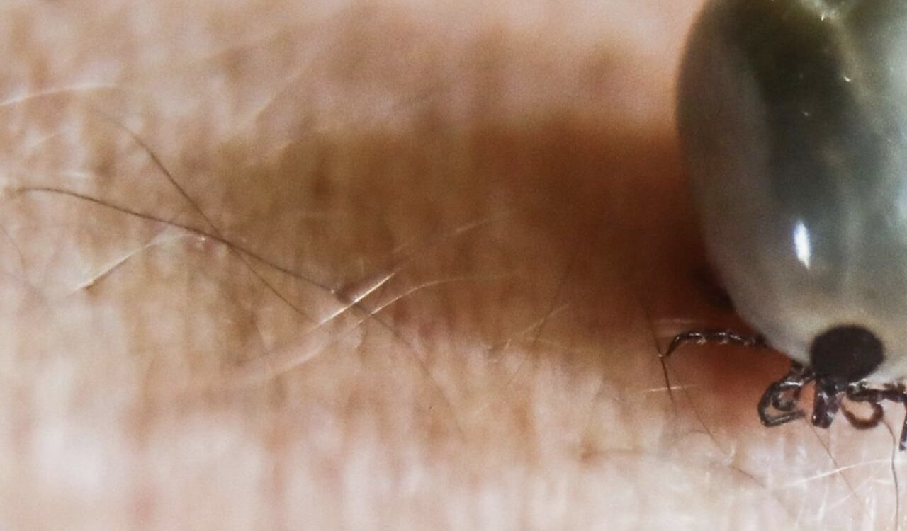 El virus Oz, transmitido por las garrapatas, le cobró la vida a una ciudadana en Japón