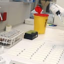 El mundo sigue buscando una cura para eliminar el coronavirus.