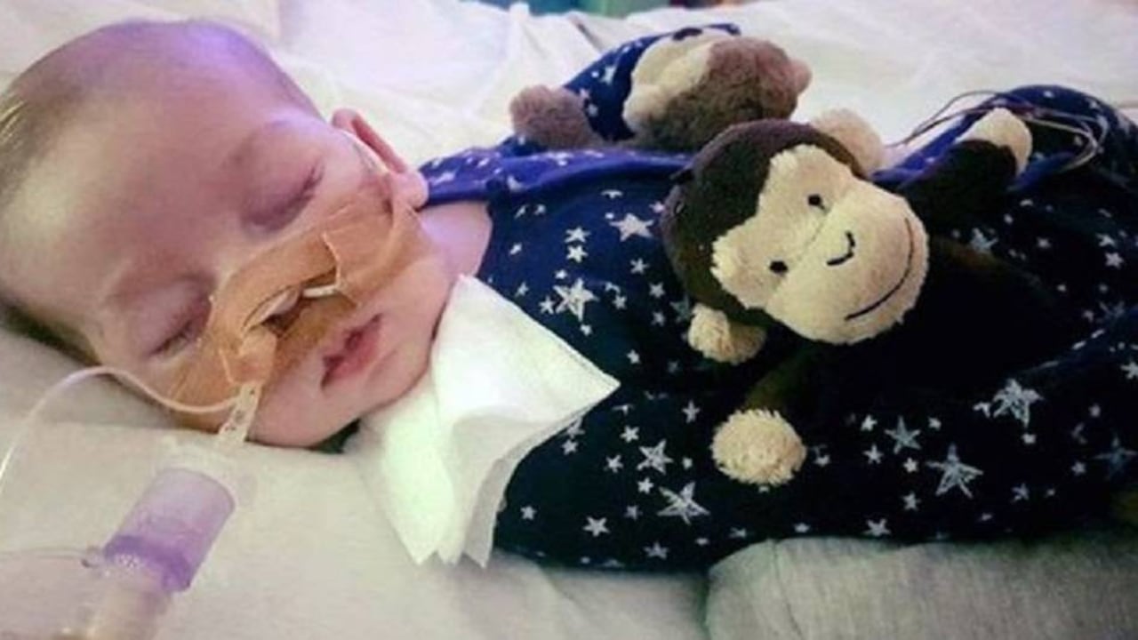 El bebé ya no puede moverse, ver, oír y se mantiene conectado a una máquina que lo alimenta y le ayuda a respirar.
