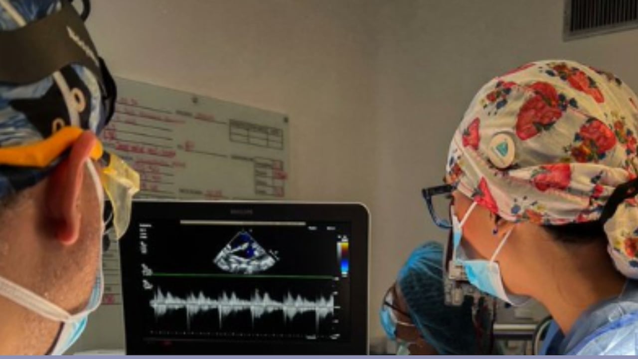 Equipo médico del Hospital General de Medellín durante la realización de una valvuloplastia pediátrica pionera en un menor Emberá Katío, un procedimiento que evitó la cirugía abierta y marcó un avance en cardiología infantil en Colombia.