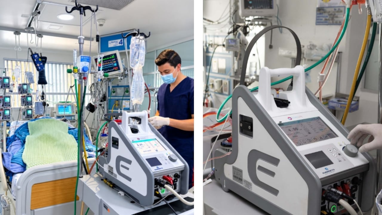 La Clínica Medilaser de Tunja puso en funcionamiento el primer programa ECMO de Boyacá. Cinco pacientes ya han recibido este soporte de alta complejidad para casos de falla cardíaca o respiratoria crítica.