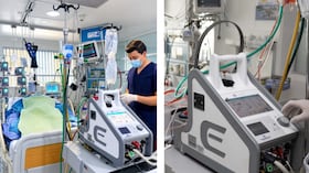La Clínica Medilaser de Tunja puso en funcionamiento el primer programa ECMO de Boyacá. Cinco pacientes ya han recibido este soporte de alta complejidad para casos de falla cardíaca o respiratoria crítica. Foto: Prensa Medilaser Tunja