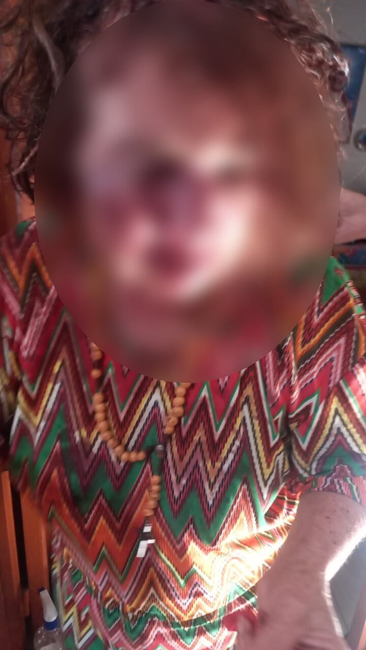 Víctima de robo en Floridablanca, Santander.