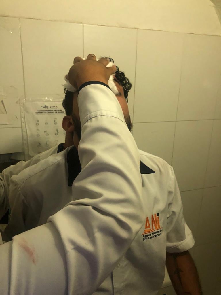 Herido en peajes de Ceballos en Cartagena