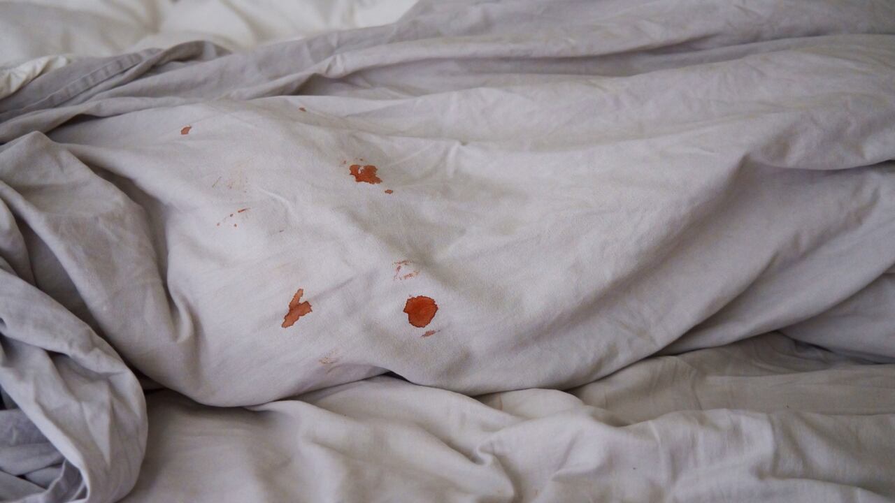 Manchas de sangre
