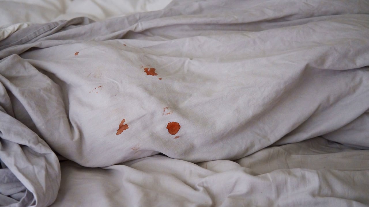 Las manchas de sangre en la ropa pueden eliminarse con algunos trucos caseros.
