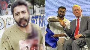 Iván Díaz, candidato al Concejo del Centro Democrático, fue agredido.