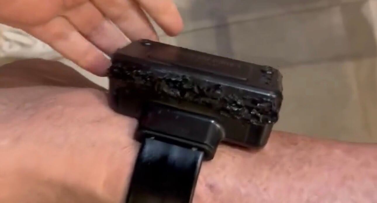 Brazalete electrónico de Bolsonaro