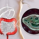 Balantidium coli protozoan in large intestine, 3D illustration. Ciliated intestinal parasite that causes balantidiasis
