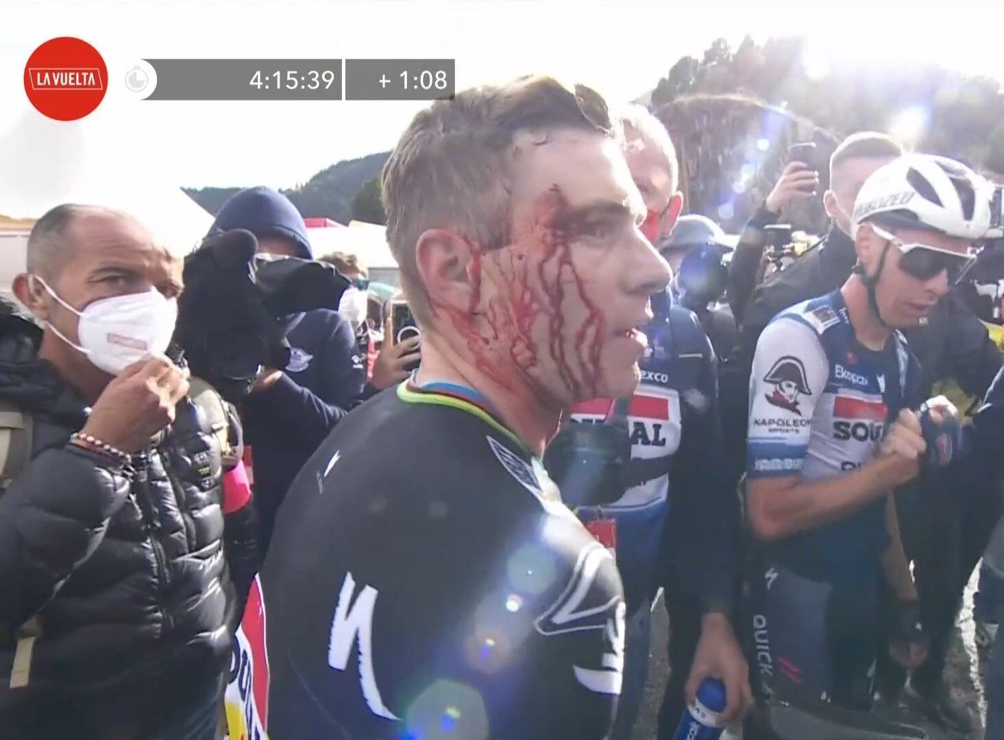 Así quedó Remco Evenepoel.