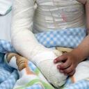 Hasta la fecha, 256 menores se han quemado por manipular pólvora.