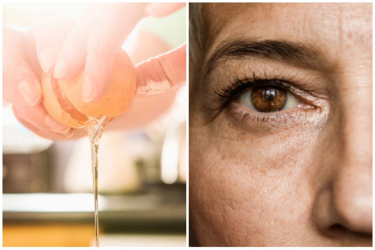 CÁSCARA DE HUEVO Y ARRUGAS