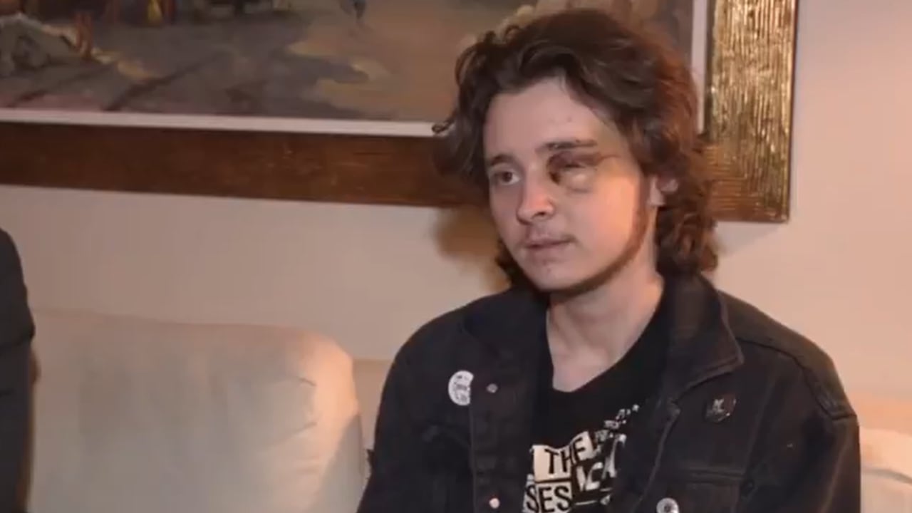 Joven atacado en marchas de ICE