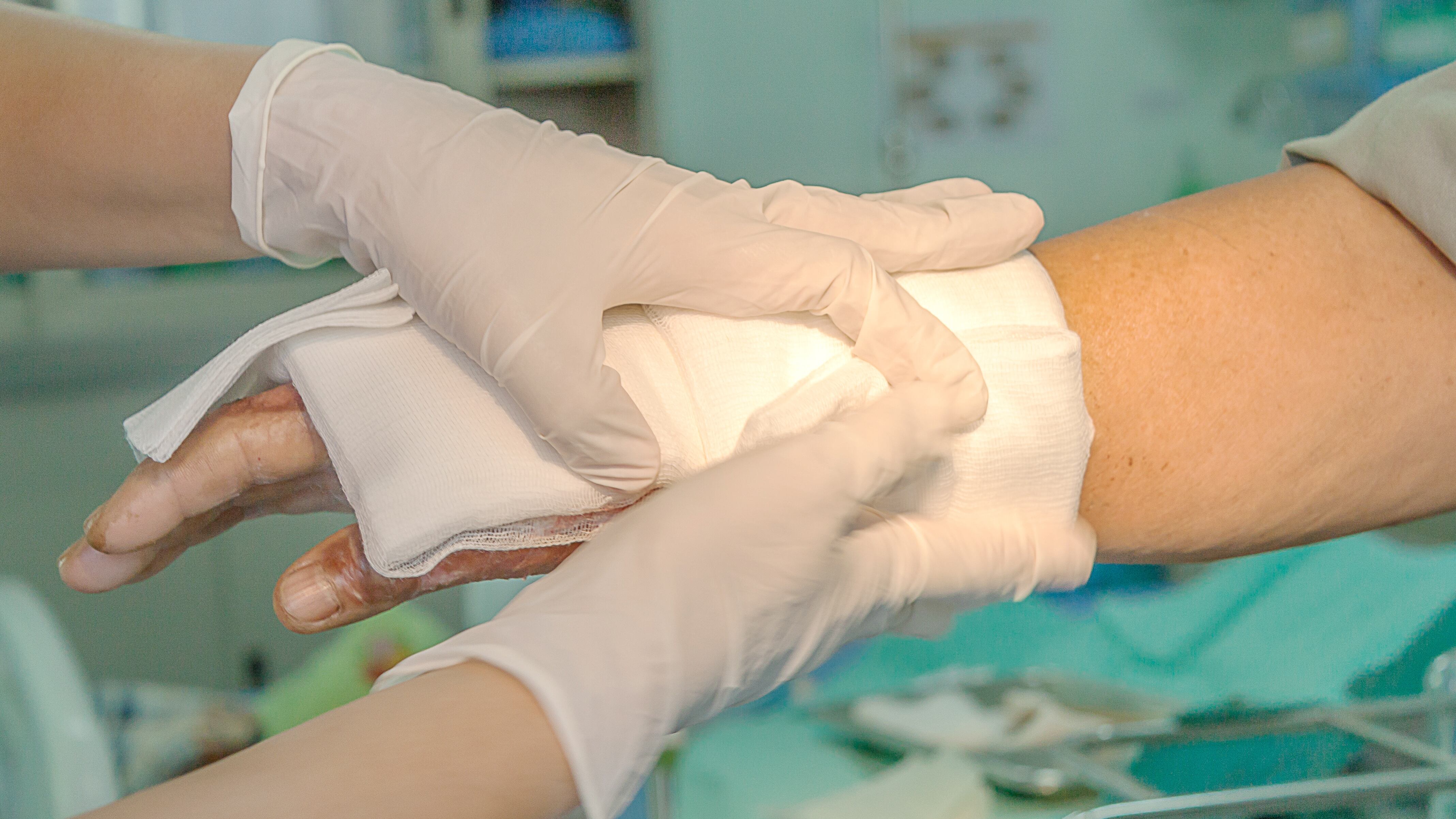 Con corte al 30 de diciembre, el Instituto Nacional de Salud ha confirmado 642 lesionados con pólvora.