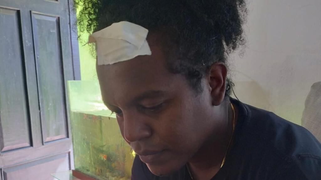 Camarógrafo de CM& denuncia agresión policial.