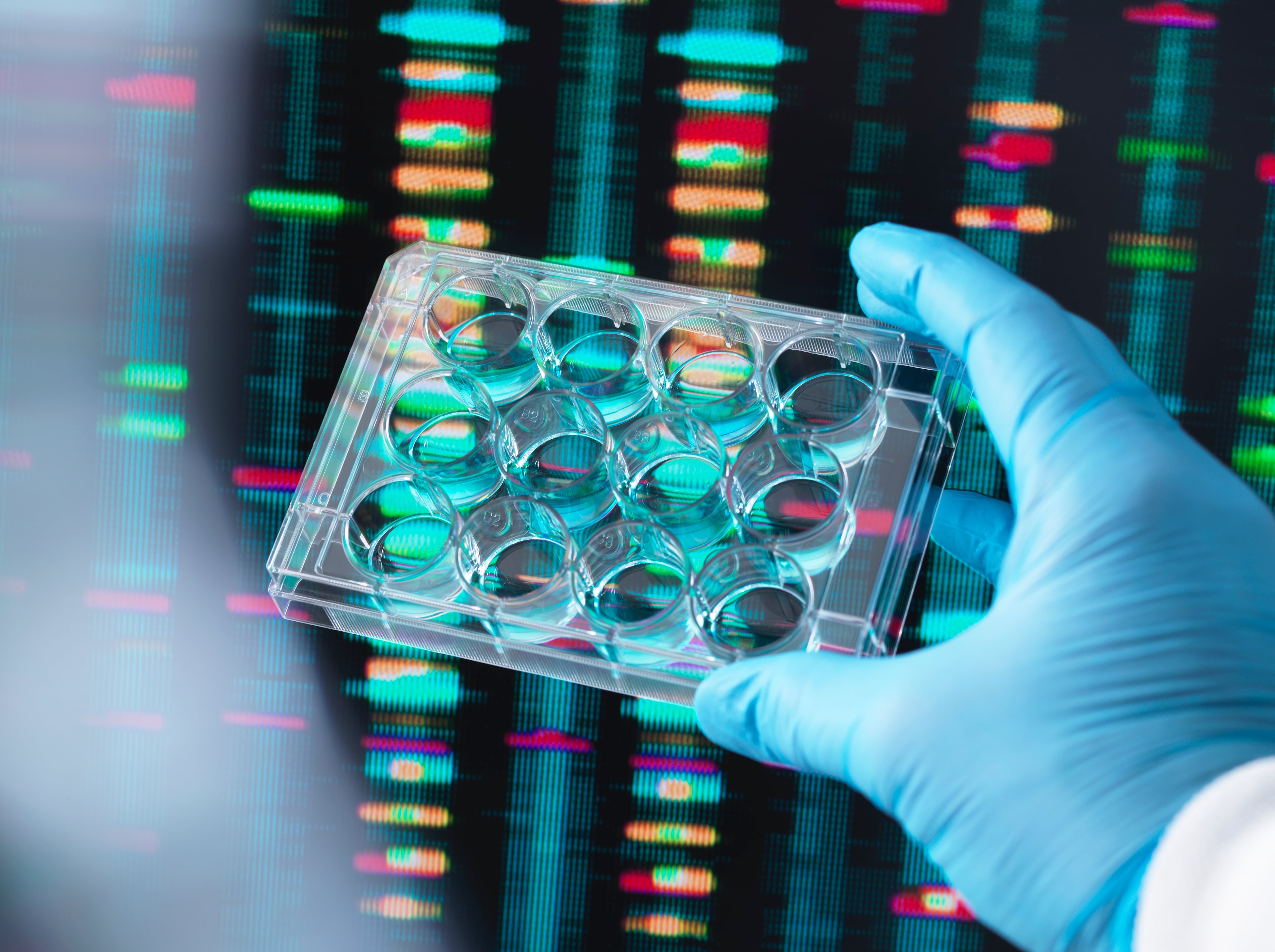 Algunos especialistas estudiaron el ADN de Brooke para encontrar las razones de su enfermedad.