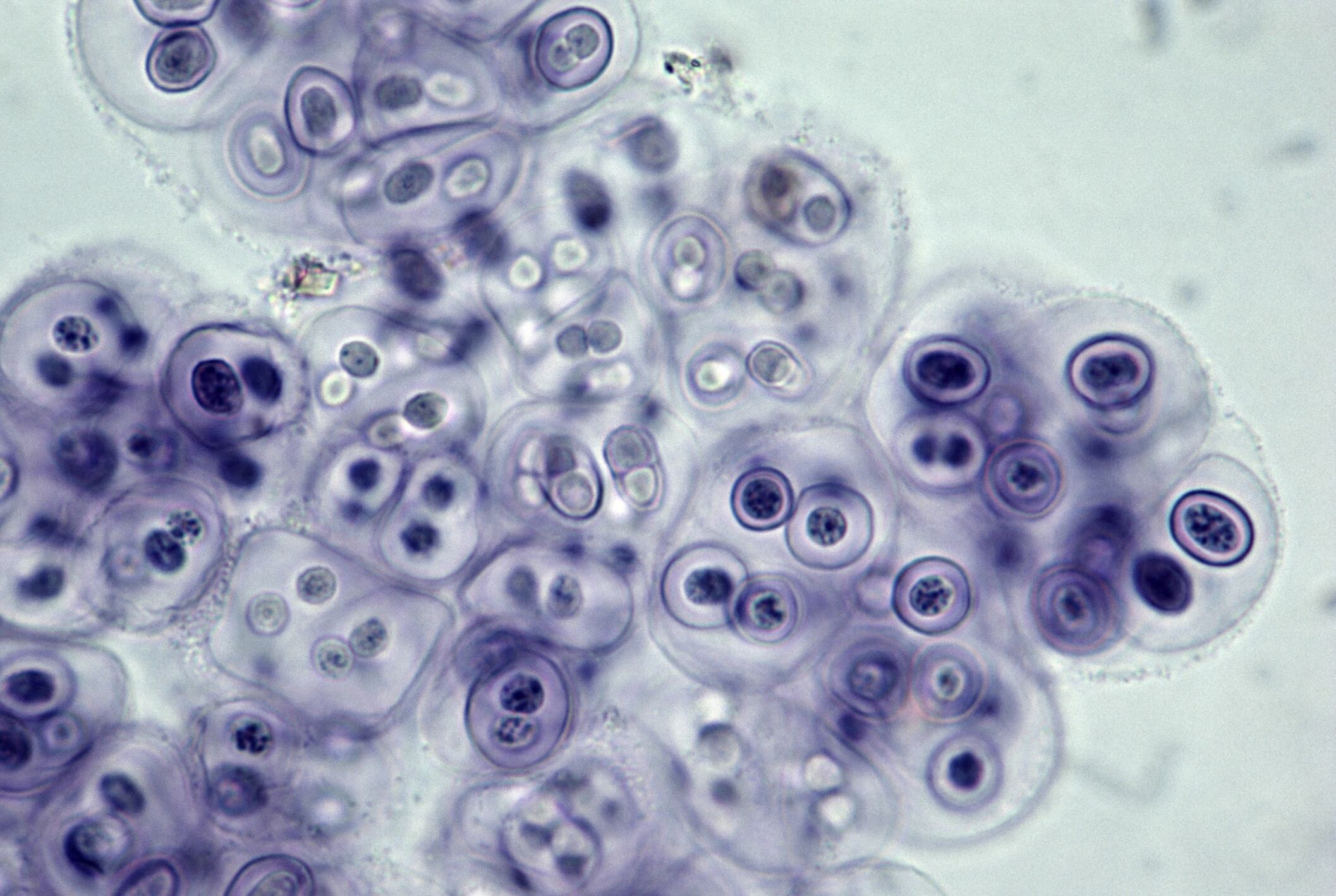 Foto de referencia sobre bacterias