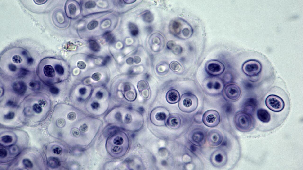 Foto de referencia sobre bacterias