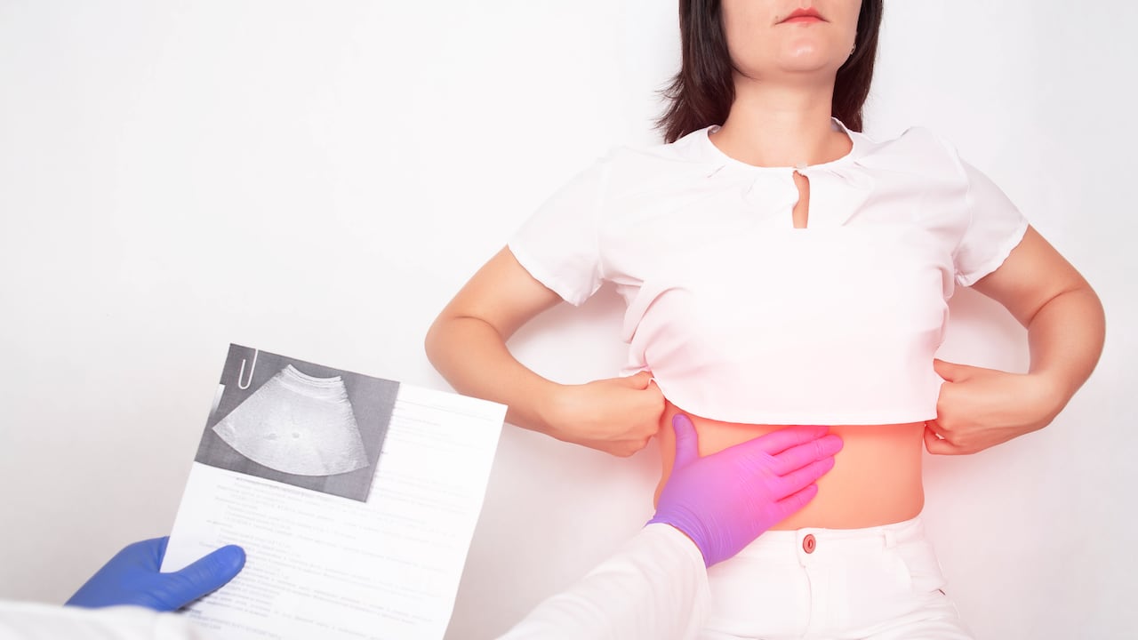 Exámenes y procedimientos en imágenes que ayudan a detectar enfermedades hepáticas