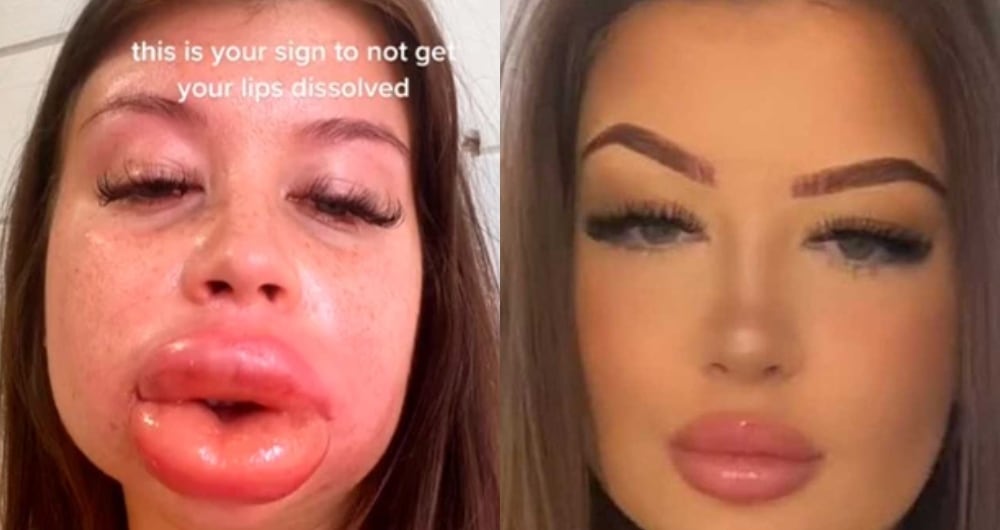 La joven Karli Gardner